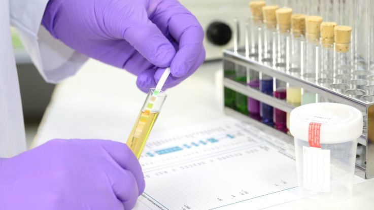 What Happens During a Drug Screening?